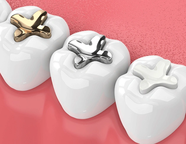 Three white tooth models with metal orthodontic brackets on pink background for dental education.
